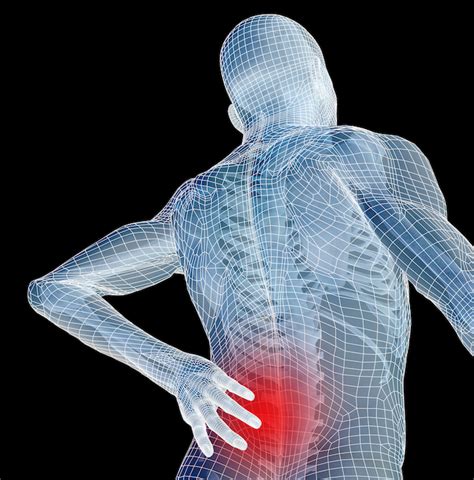 Mechanical Back Pain Sprainsstrains