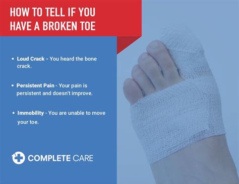 Sprained Toe Vs Broken Toe How To Tell The Difference