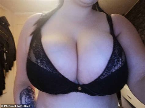 Woman 26 Launches Crowdfund For Breast Reduction Surgery For Her 40hh