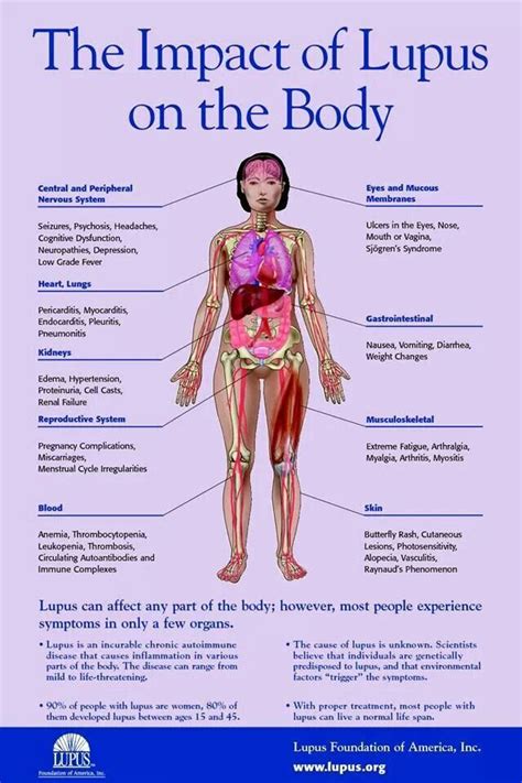 Lupus Impact On The Body Scheduled Via Utm