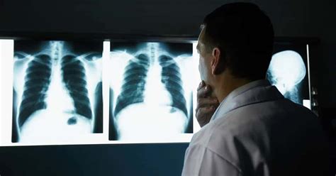 Radiografia O Que é Raio X E Como Funciona O Exame