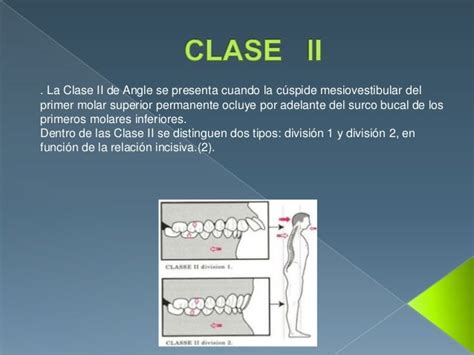 Clase Ii