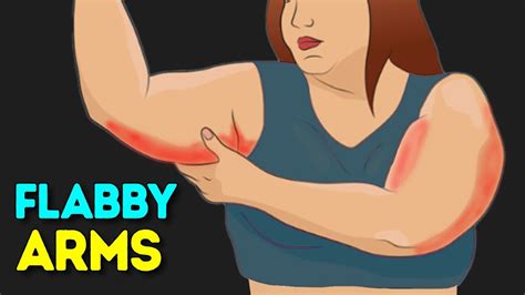 Fix Flabby Arms How To Lose Arms Fat At Home Youtube