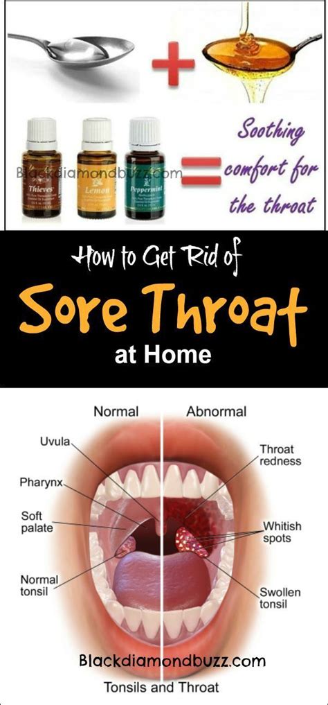sore throat remedies how to get rid of sore throat fast at home using essential oil honey an