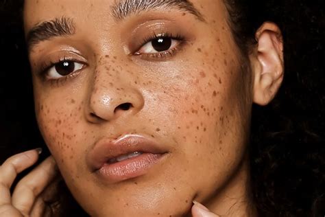Why Freckles Are The Statement Making Beauty Look Du Jour Freckles