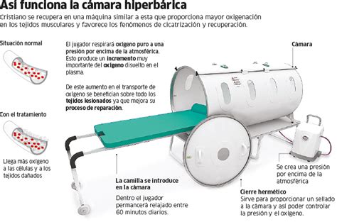 La cámara hiperbárica mejora tu calidad de vida, está supervisada por un médico especialista que la combina con el tratamiento específico. Real Madrid: ¿Cómo funciona la cámara hiperbárica que está ...