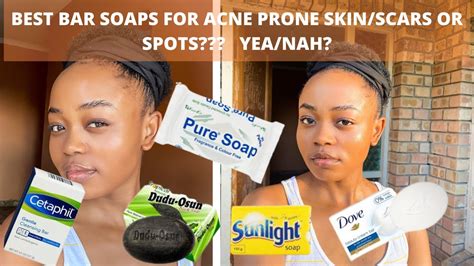 Best Soaps For My Acne Prone Skin Acne Spot Dark Marks Imperfections
