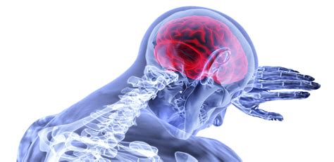 Accidentul Vascular Cerebral Cauze Simptome Tratament