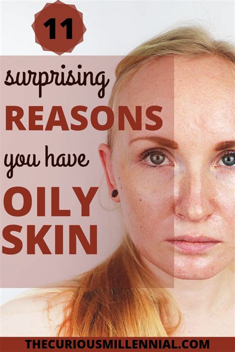 11 Surprising Reasons Why Your Skin Is Oily Oily Skin Remedy Oily