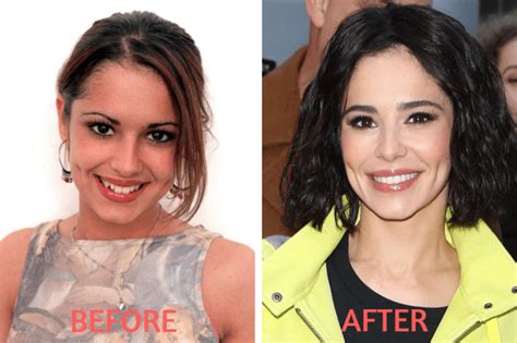 Celebrity Before And After Plastic Surgery Shock Transformations