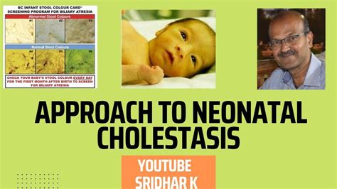Approach To Neonatal Cholestasis Dr Sridhar K Cholestasis