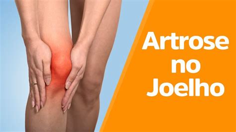 Tudo Sobre Artrose No Joelho Parte Fisioprev Youtube