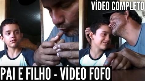 Pai Cuidando Do Filho Que Martelou O Dedo VÍdeo Completo Youtube