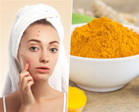 Here Is Your Guide To Use Raw Turmeric For Acne Herzindagi