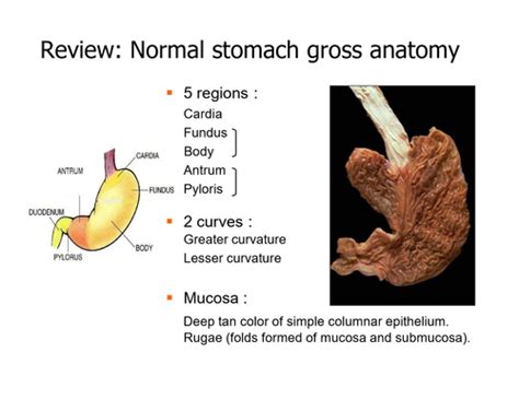 Pathology Of Gastric Diseases Stomach Path Flashcards Quizlet