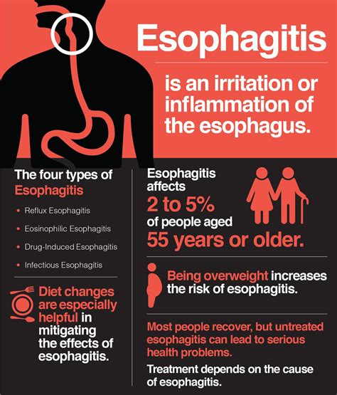 Esophagitis Symptoms Causes And Treatments The Amino Company