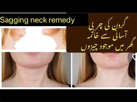 Remedy For Sagging Neck Hindi Urdu YouTube