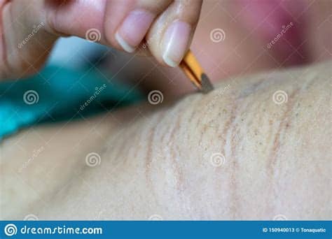 While men mostly get away with two simple decisions if we do decide to get rid of our body hair, then we're faced with a whole new set of complications. Close Up Hand Of Woman Plucking Armpit Hair Removal Stock ...