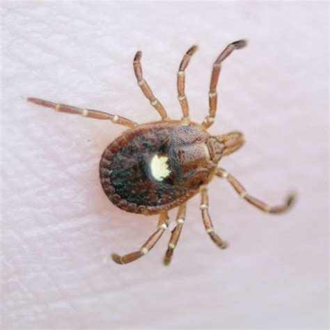 Alpha Gal Syndrome From Tick Bites Can Cause Meat Allergy Tick Bite