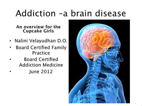 Addiction A Brain Disease