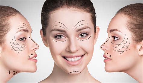Lifting Facial Aptos Estheticones