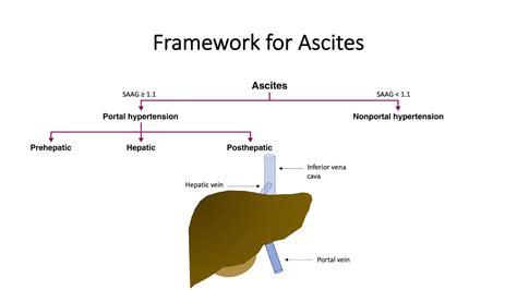 Differential Diagnosis Of Ascites Youtube