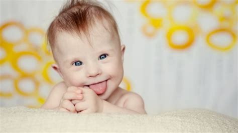Día Mundial del Síndrome de Down Guía de procedimientos que debes hacer si tu bebé lo padece