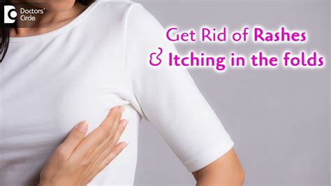 Rashes Below Breast Fold Remedies To Avoid Itching Under Folds Dr