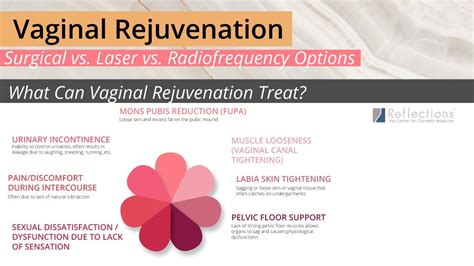 Options For Feminine Rejuvenation [vaginal Rejuvenation Labiaplasty Thermiva And More Compared