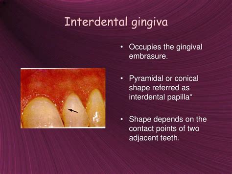 Ppt Structure And Functions Of The Gingiva Powerpoint Presentation