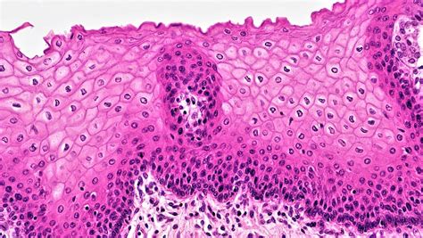Difference Between Simple Squamous Epithelium And Stratified Squamous