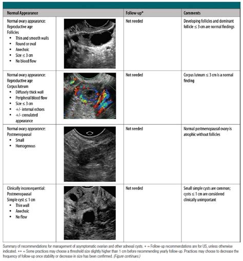 Ovarian Cyst Fu Guideline Radiologyworld
