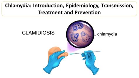 Chlamydia Introduction Epidemiology Transmission Treatment And