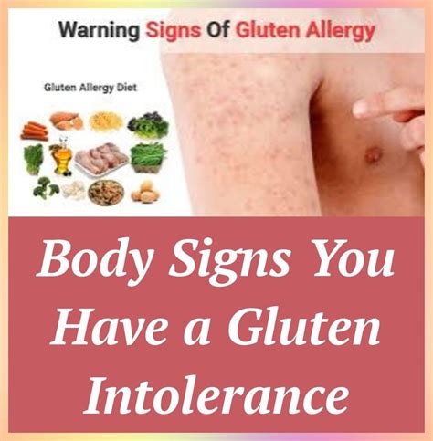 Body Signs You Have A Gluten Intolerance Gluten Intolerance Gluten Intolerance Symptoms