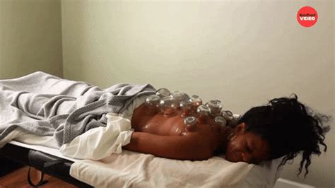 Therapy Cupping Gif By Buzzfeed Find Share On Giphy