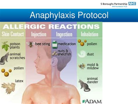 Ppt Anaphylaxis Protocol Presented By Dave Prescott Resuscitation