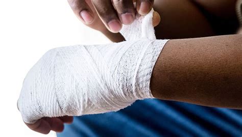 Common Burn Injuries In Personal Injury Claims The Embry Law Firm