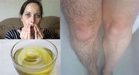 remove unwanted body hair in 5 minutes with this natural recipe