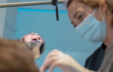 Qu Hacen Los Higienistas Dentales Nart Cl Nica Dental