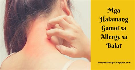 Mga Halamang Gamot Sa Allergy Sa Balat Pinoy Health Tips