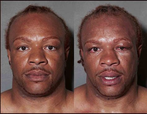 Photos Boxers Before And After Fights Boxer Fight Howard Schatz