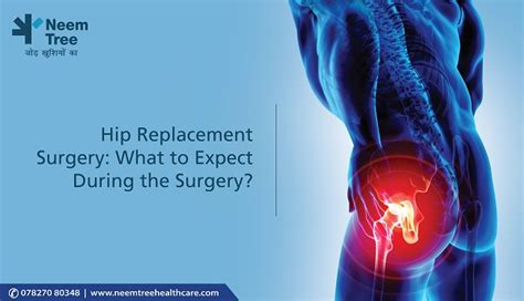 Hip Replacement Surgery What To Expect During The Surgery Neemtree