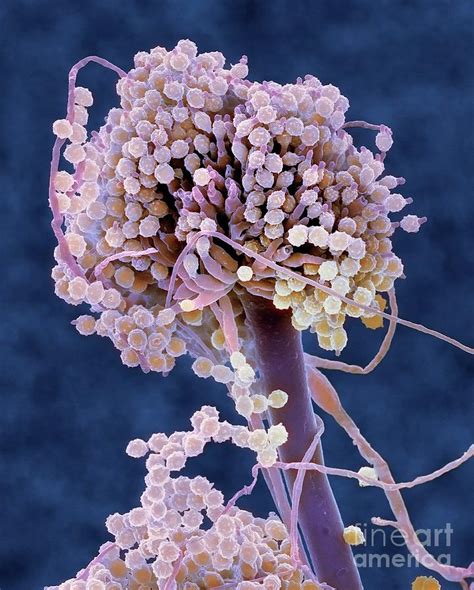 Aspergillus Fungus Conidiophores Photograph By Dennis Kunkel Microscopy