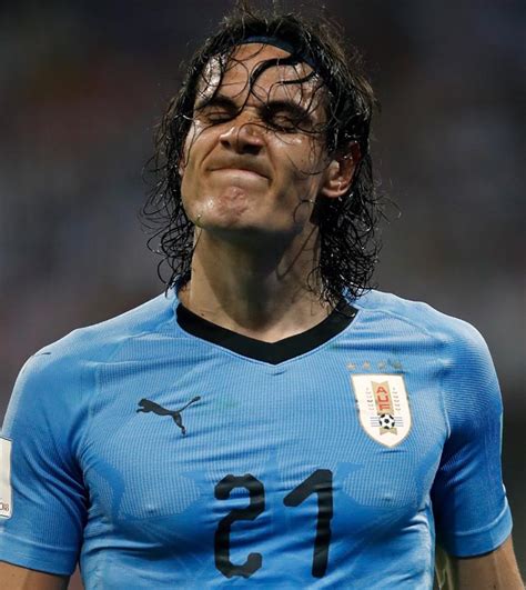 This is the injury history of edinson cavani from manchester united. 'Uruguay without Cavani is not the same' - Rediff.com Sports