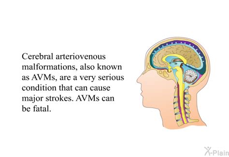 Avm And Surgical Treatment