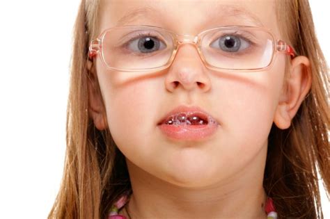 Seven Tips To Stop Your Child With Special Needs From Drooling