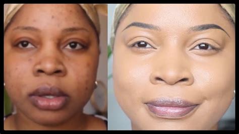 how to cover acne scars dark spots full coverage youtube