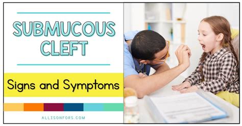 Signs And Symptoms Of Submucous Cleft Palate Allison Fors Inc