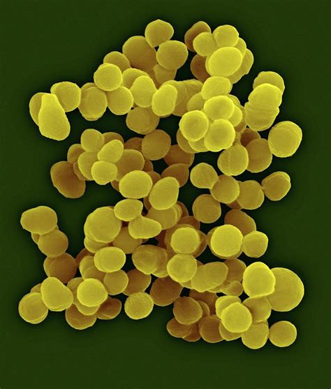 Aerococcus Urinaeequi Photograph By Dennis Kunkel Microscopyscience