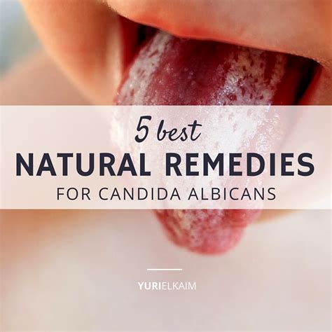 The Candida Cure 5 Natural Treatments For Getting Rid Of It Yuri Elkaim
